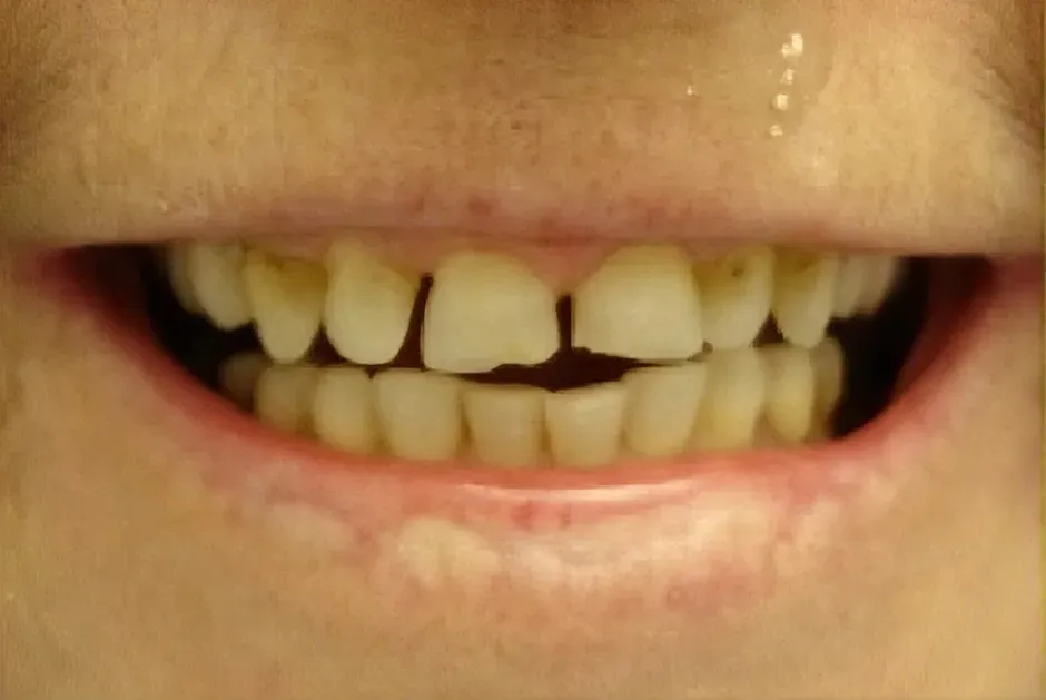 Smile before treatment
