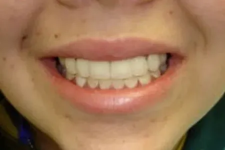 Smile after treatment