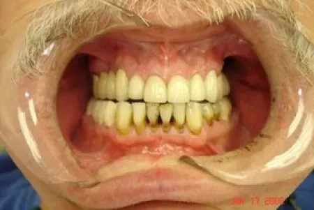 Smile before treatment
