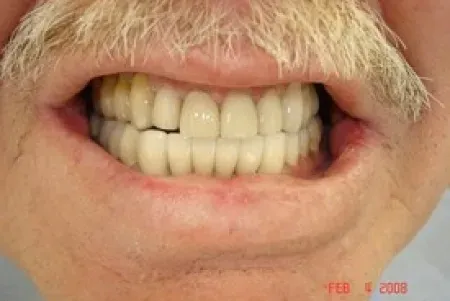 Smile after treatment
