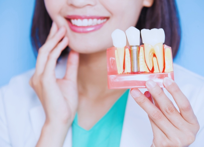 How to Make Your Dental Implants Look Amazing in 9 Days