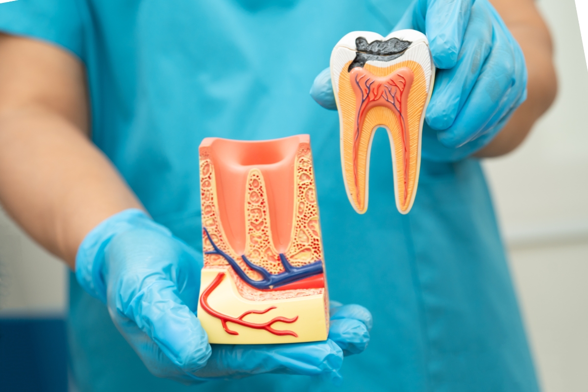 root-canal-therapy-in-Glendora