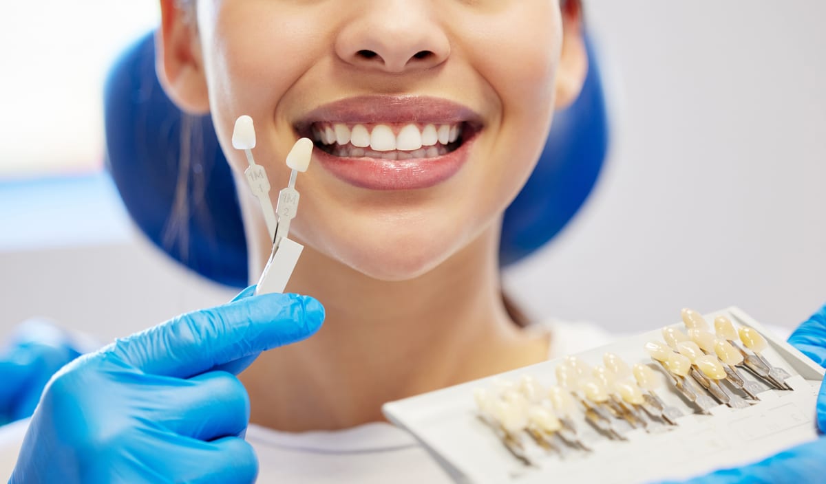 Veneers in Citrus