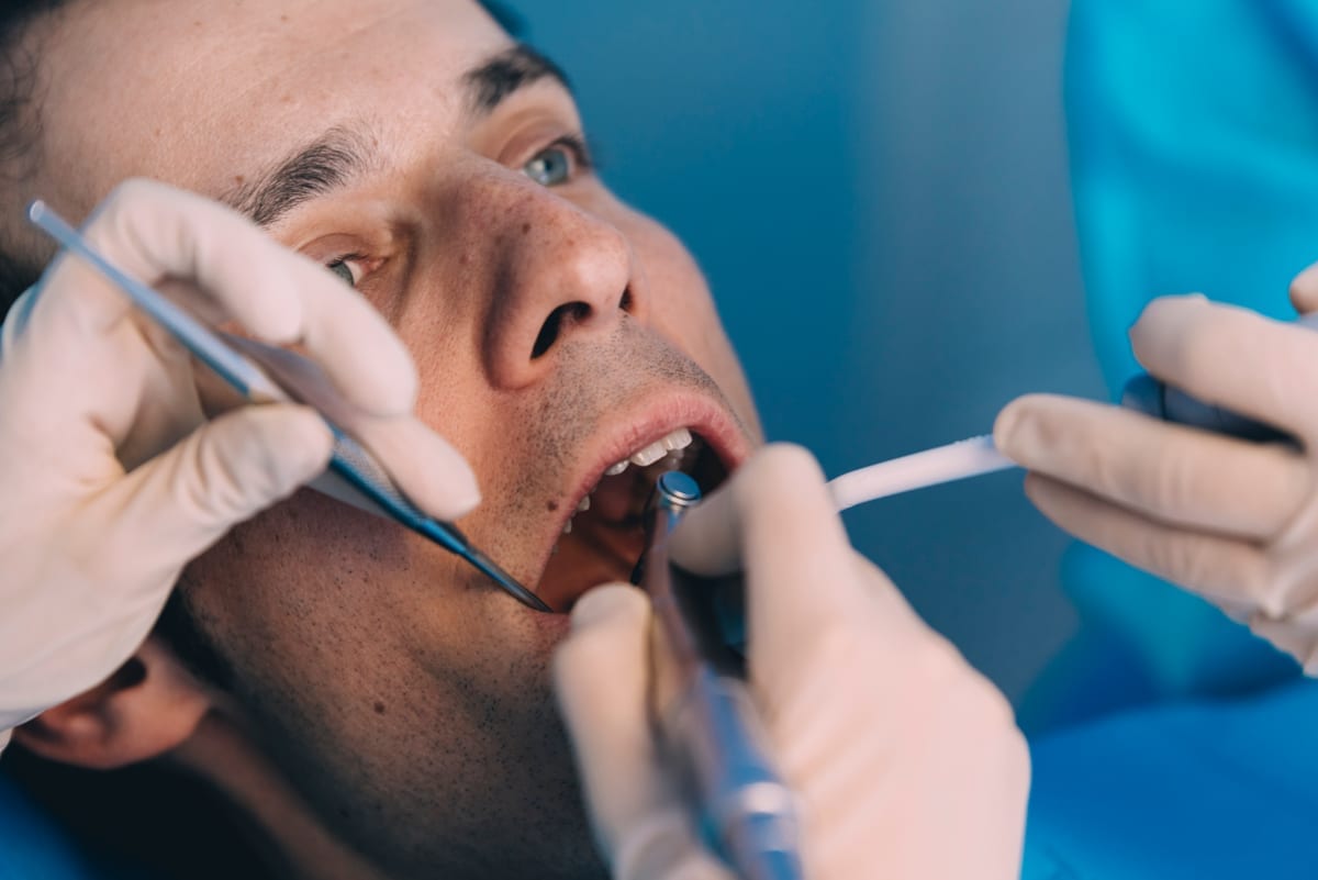 Root Canal Treatment in Glendora